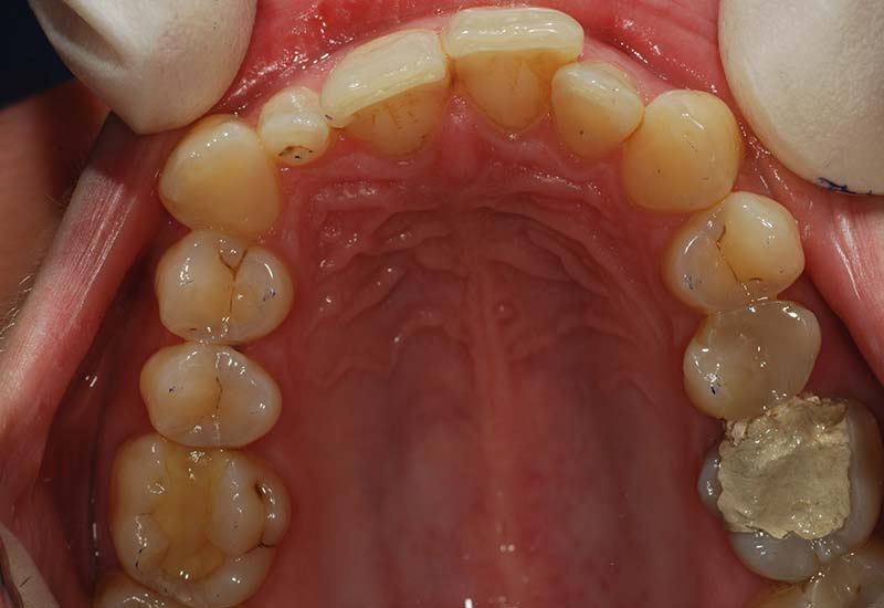 Before
