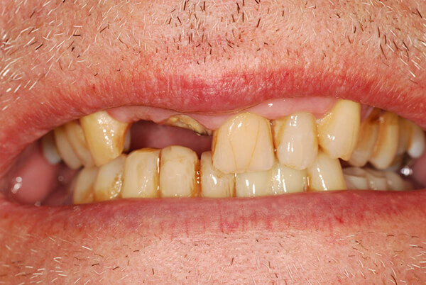 Before